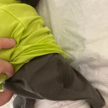 Prima Sızdırma Problemi Lütfen Çözüm İstiyorum