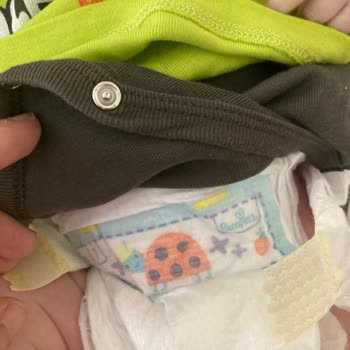 Prima Sızdırma Problemi Lütfen Çözüm İstiyorum