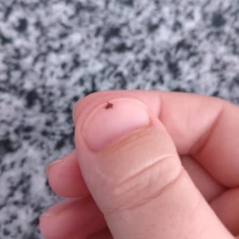 İzmir Büyükşehir Belediyesi Mahalle Pire Dolu