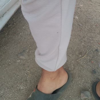 İzmir Dikili Belediyesi Acil Yardım Her Yer Pire Kaynıyor!