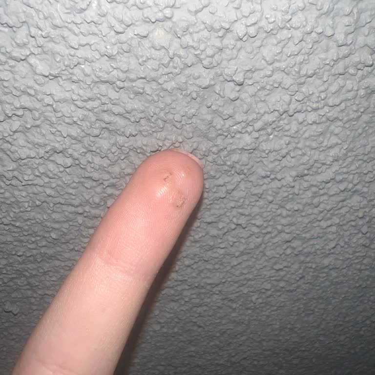 Valeria Platinum Beauty Hijyensizlik Ve Sonucu