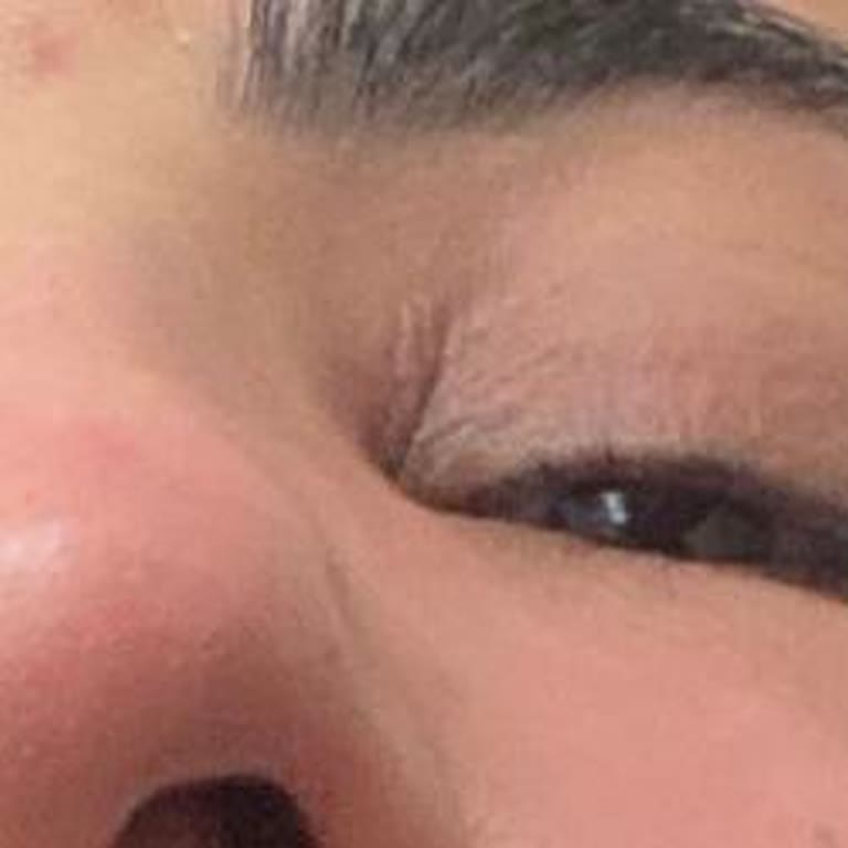 Dr. Can Taşkıran Memnuniyetsizlik Ve Anlaşmazlık