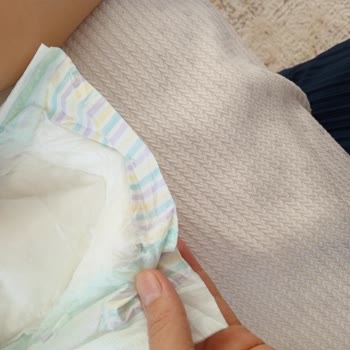 Jenny & Willy Bezler Yırtık Ve Pulları Dökülüyor