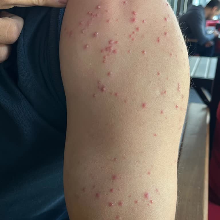 Le Petit Marseillais Duş Jeli Cildimde Sorun Yarattı