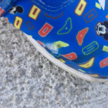 Amazon Onlinedan Alınan Adidas Çocuk Ayakkabısının Kalite Sorunu
