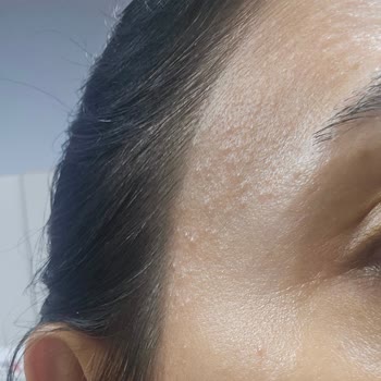 Cream Co Cilde Zarar Veren Ürün Satıyor.