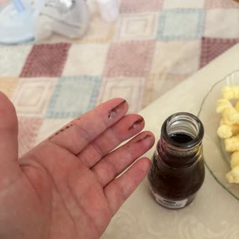 Sırma Sodaları Paslı Veya Boyalı
