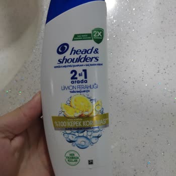 Head Shoulders'ın Yeni Formülü Saç Dökülmesine Neden Oluyor