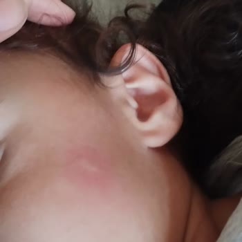 Özel MOReFİLL Kreş ve Gündüz Bakımevi Çocuğumun Güvenliği Ve Şeffaflık Sorunları