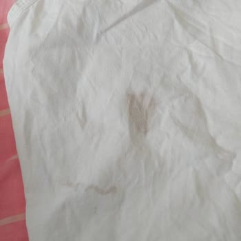 Bosch Çamaşır Makinesi Ve Servis Hizmetleri Hayal Kırıklığı!