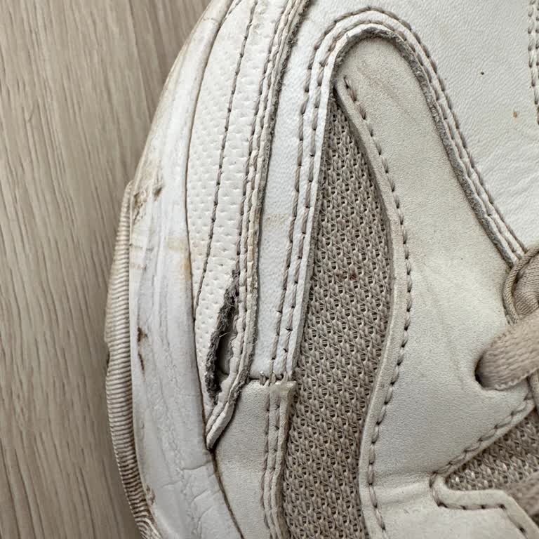 Skechers Ayakkabı 5 Ay İçinde Patladı