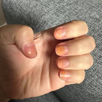 Flormar Oje İçeriği Sararttı