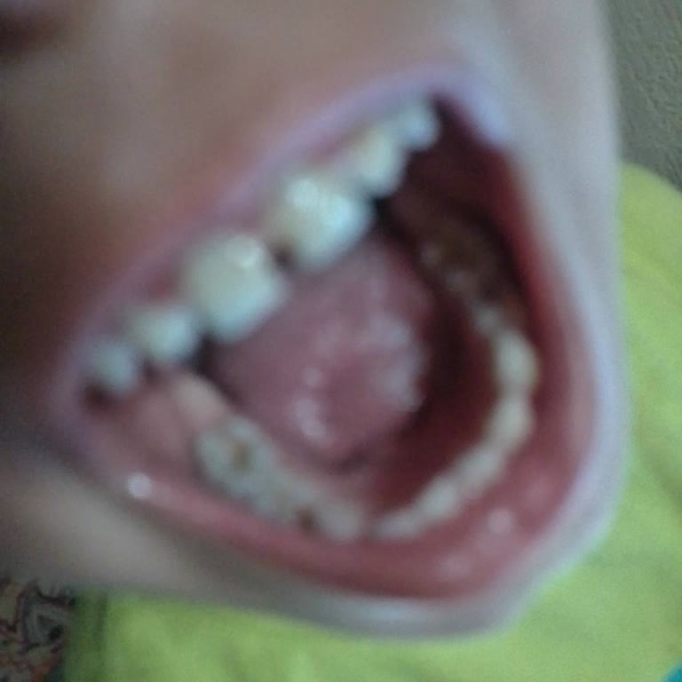 Behçet Uz Çocuk Hastanesi Çocuk Hastaları İçin Yetersiz Hizmet Ve İlgisizlik