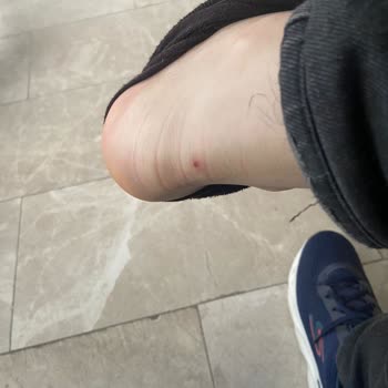 No puedo devolver mis zapatos defectuosos de Skechers