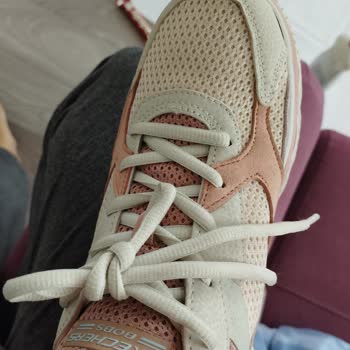 Skechers: Zapatos Deformados en 20 Días