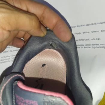 Skechers Zapatos Se Desarman en un Mes, Soporte Postventa Decepcionante