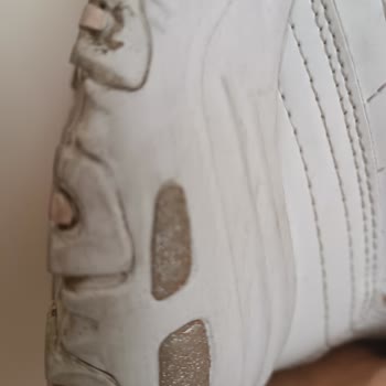 Skechers Zapatos Despegándose en Menos de un Año