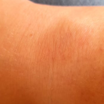 Cortes en mi muñeca por Huawei Watch 3 Elegant Smartwatch