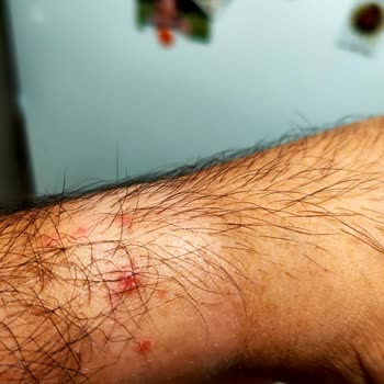 Huawei Watch GT3 Pro: Irritación con la Correa de Silicona