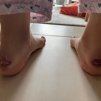 Mis zapatos nuevos de Nike me lastimaron los pies