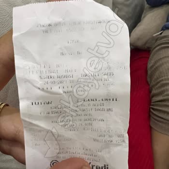 Burberry Gözlük Camımda Soyulmalar Var