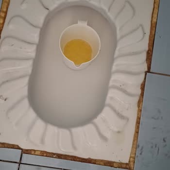 Milli Eğitim Bakanlığı WC Bakımsızlığı Ve Pisliğinin Giderilmesi