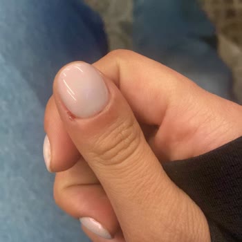 Kirpiks Beauty Home Manikür Sonrası Yaşadığım Sağlık Sorunları