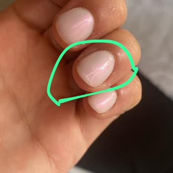 Kirpiks Beauty Home Manikür Sonrası Yaşadığım Sağlık Sorunları