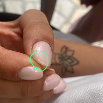 Kirpiks Beauty Home Manikür Sonrası Yaşadığım Sağlık Sorunları