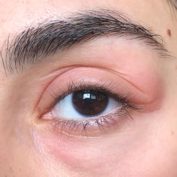 La Roche-Posay Lipikar Syndet AP+ Gel Limpiador Irrita Mis Ojos