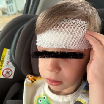 Alarcha Hotels & Resorts Otelin İhmali Ve İlgisizliği Bebeğimin Sağlığını Tehlikeye Attı