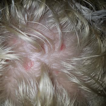 Palette 10.1 Rubio Cenizo Me Causó Ampollas y Lesiones