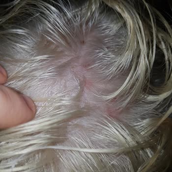 Palette 10.1 Rubio Cenizo Me Causó Ampollas y Lesiones