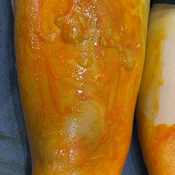 Homend Tea Maker explotó después de 3 meses – Lesión por agua hirviendo