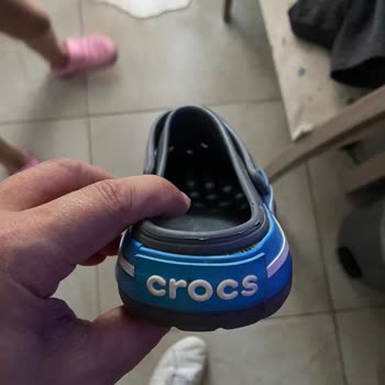 Crocs Zapatillas: Problema con Daños del Sol