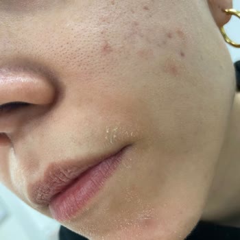 Garnier C Gel Limpiador Facial Secó Mi Piel