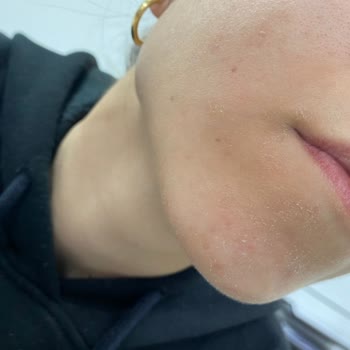 Garnier C Gel Limpiador Facial Secó Mi Piel