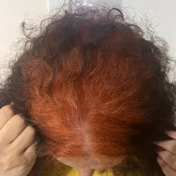 Garnier Color Naturals No. 5 Marrón Claro volvió Naranja el Cabello de Mi Madre