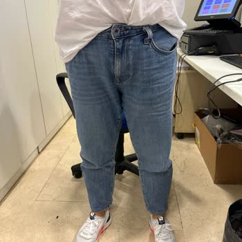 Mavi Bollaşma Şikayeti