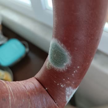 A101 Küflü Sucuğu İade Almadı