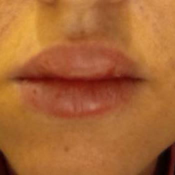 Vogue Lux Güzellik Merkezi Zorla Satış