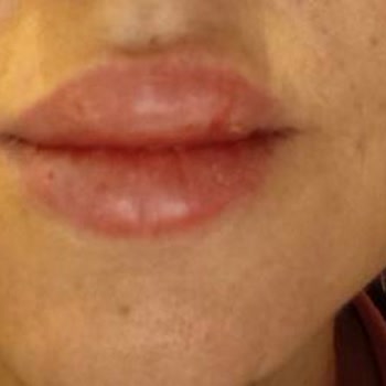 Vogue Lux Güzellik Merkezi Zorla Satış