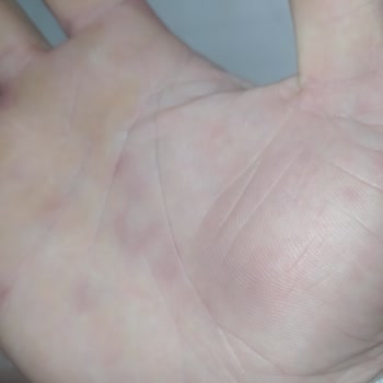 KFC 230 Kusur Lira İçin Hastalığımı Önemsemiyor Bir Mekan Müdürü