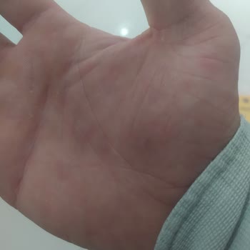 KFC 230 Kusur Lira İçin Hastalığımı Önemsemiyor Bir Mekan Müdürü