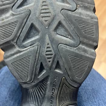 Skechers Mağduriyeti Ve Pişmanlığı