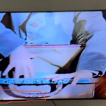 Samsung TV’de Garanti Bitimi Sonrası Kronik LED Panel Arızası