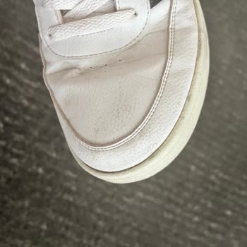 Adidas Marka Ayakkabı Deforme Sorunu
