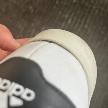 Adidas Marka Ayakkabı Deforme Sorunu