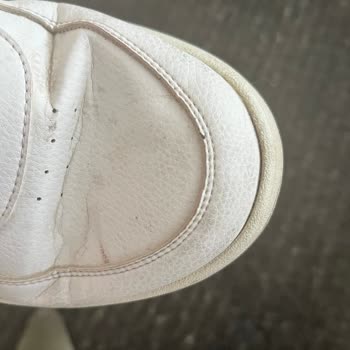 Adidas Marka Ayakkabı Deforme Sorunu