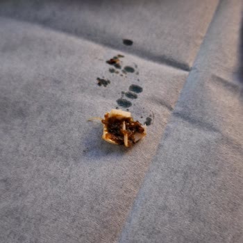 Pek Food 4'lü Lahmacunun İçinden Sert Plastik Çıktı!